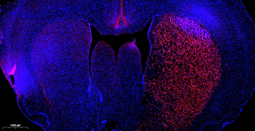 Kit de detección de apoptosis de células de tono rojo TMR para la sección de parafina Sección de tejido congelado Celular Cell Spear