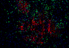 TSA Fluorescencia Kit de tinción doble Tiramida Amplificación de señal de inmunofluorescencia Reactivo