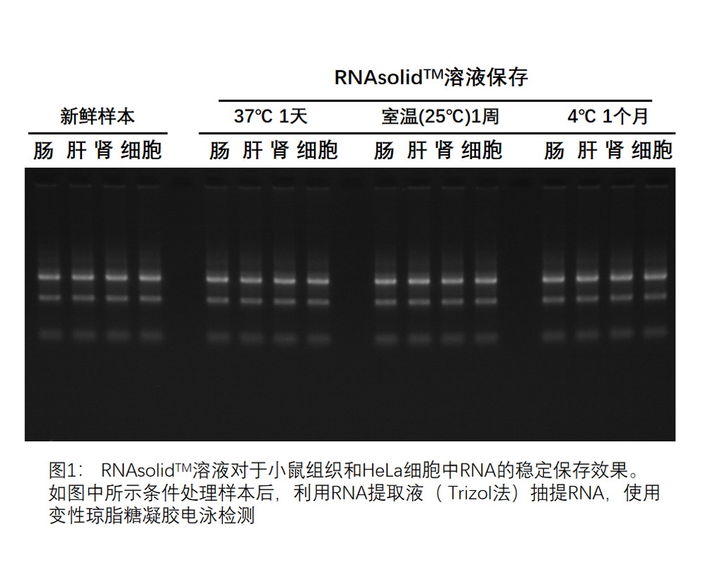 Solución de preservación estable del ARN del tejido sólido de ARN para el reactivo de extracción de ácido nucleico
