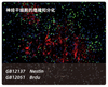 Kit de tinción triple de fluorescencia Tsaplus Amplificación de señal de tiramida Reactivo de inmunofluorescencia