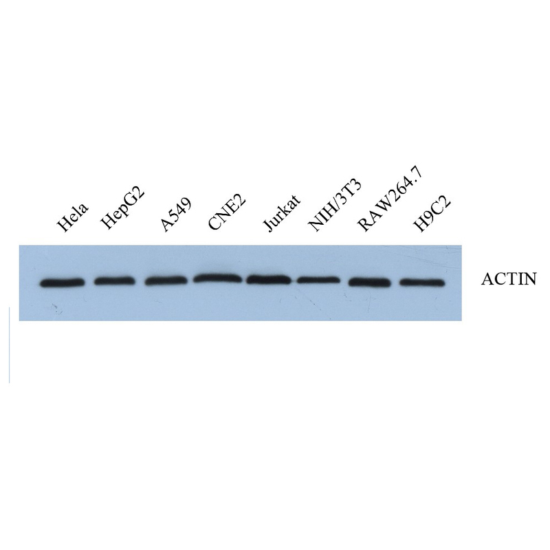 Anticuerpo de control de la carga del conejo de la actina anti -beta para WB