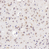 Anti-GDNF Pabbit pab inmunohistoquímico anticuerpo policlonal
